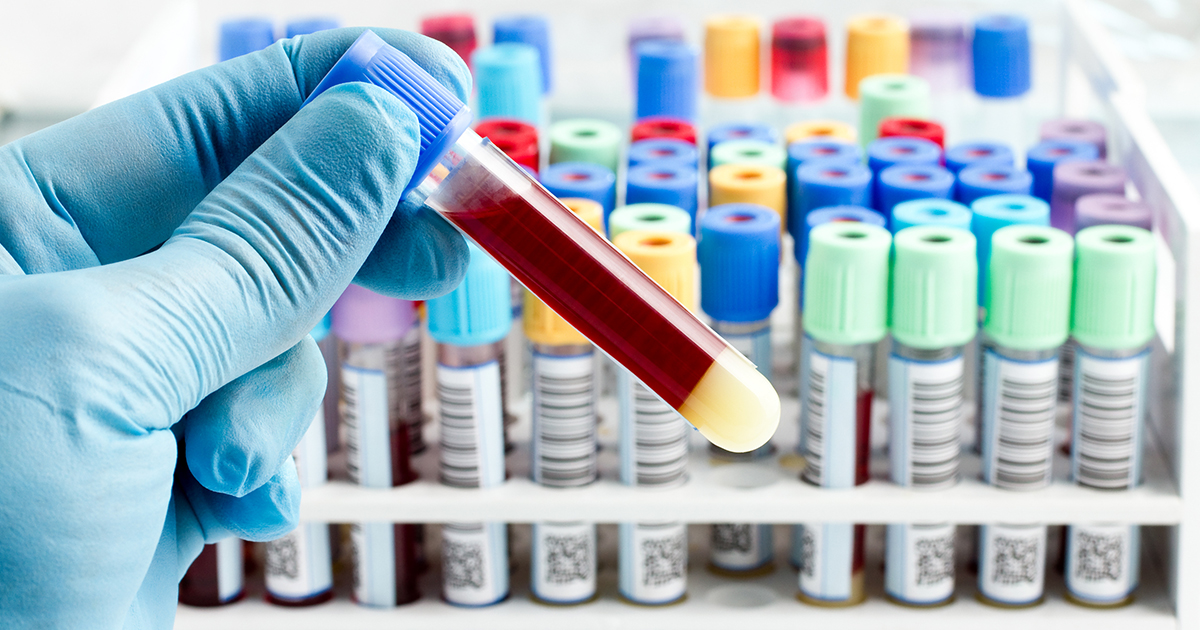 Blood and Urine Test