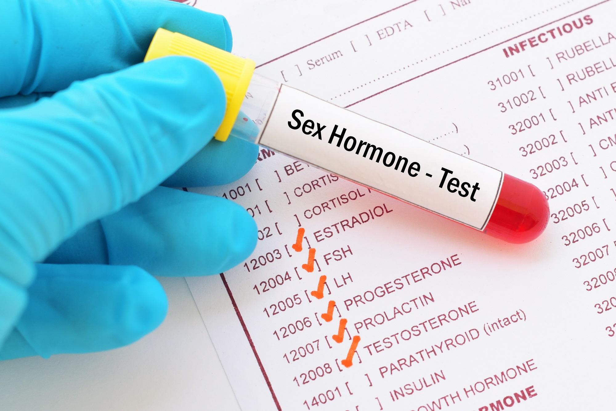 Hormones Test