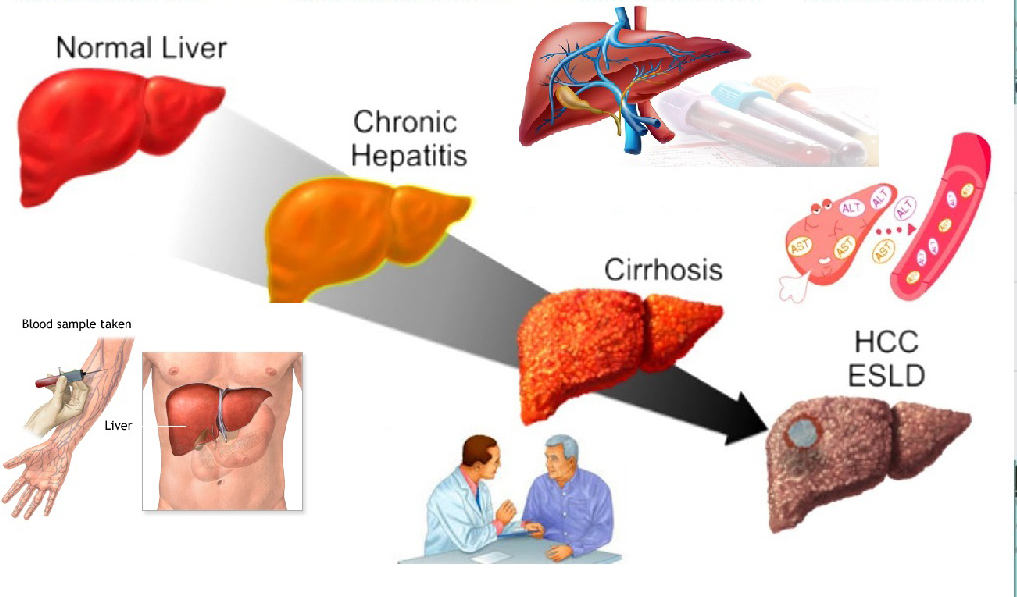 Liver Function Test