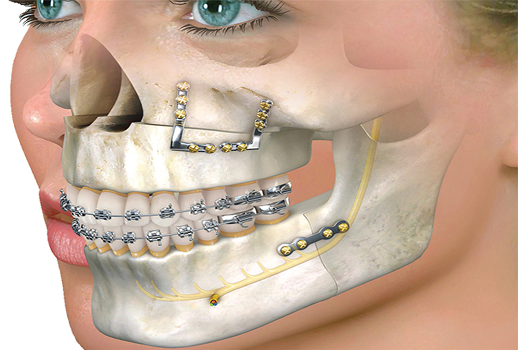 Maxillofacial