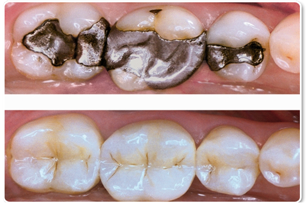 Dental Implantation